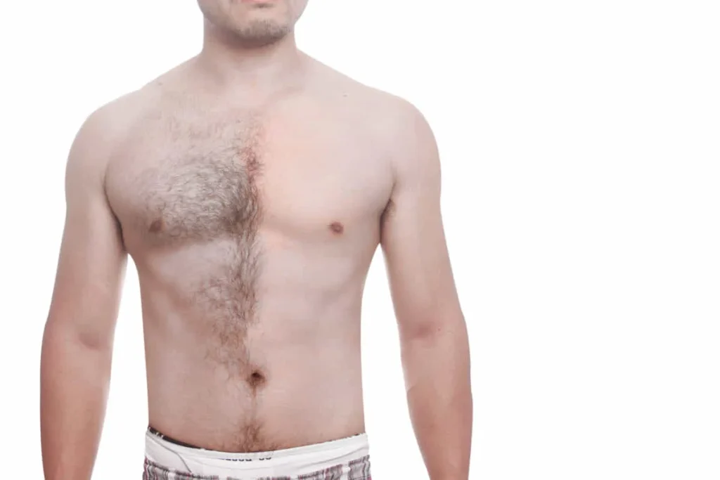 Body Hair Fall: Shocking Causes and Cures