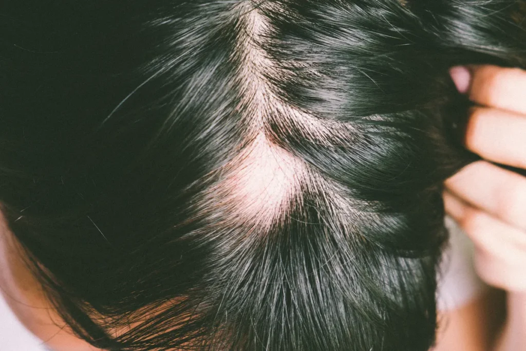 Understanding Folic Acid and Its Role in Hair Health