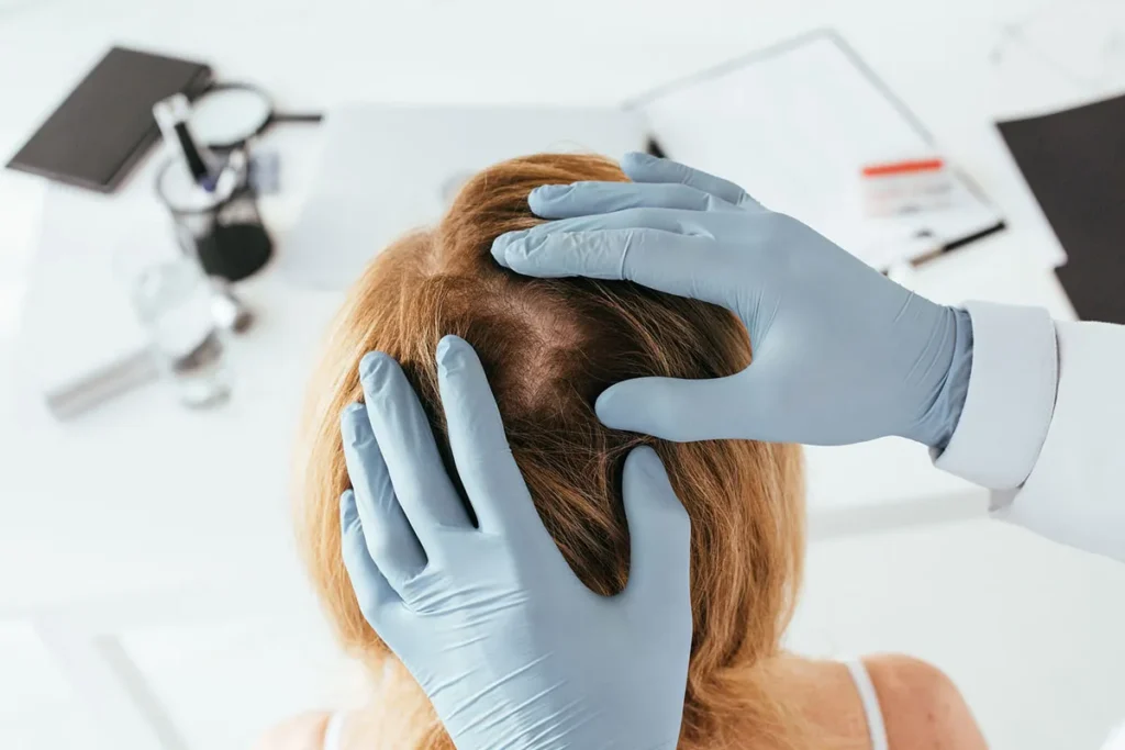 Can Hair Grow Back After Balding? The Science Explained