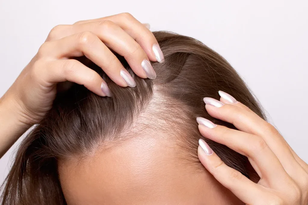 Can Too Much Vitamin B12 Cause Hair Loss?