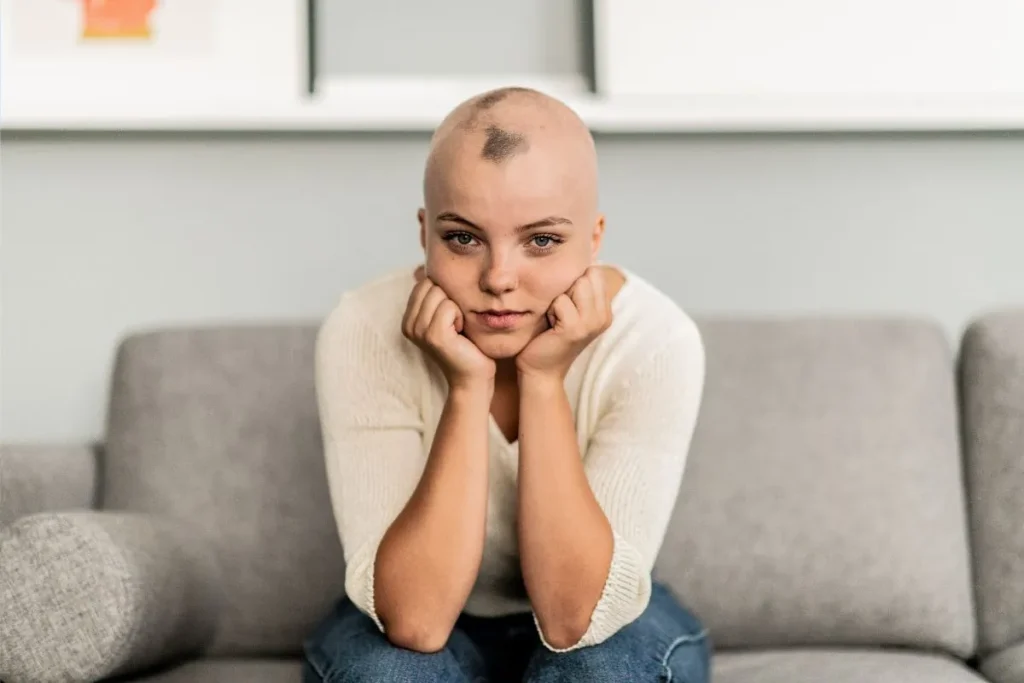 Can Women Get Male Pattern Baldness? Relief