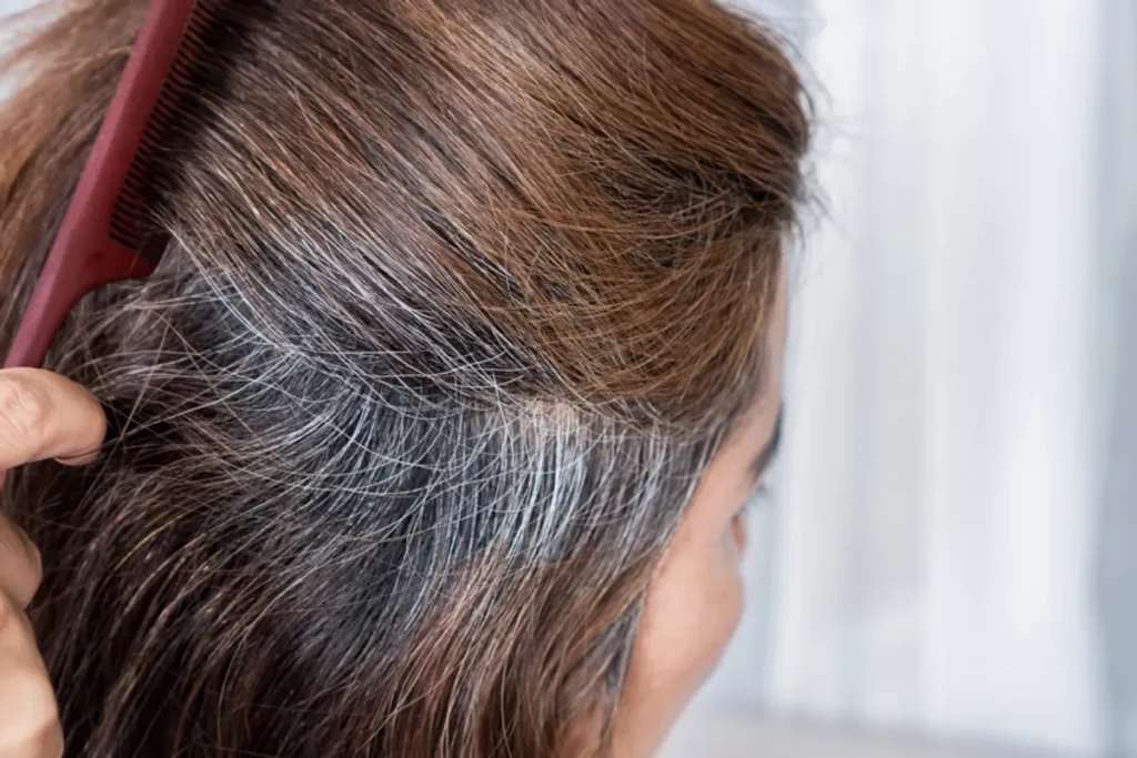 Can You Stop Using Minoxidil? Vital Risks