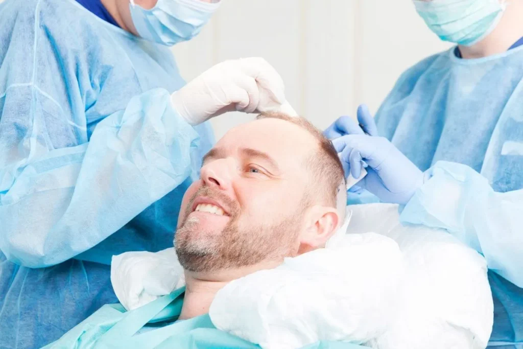 Celebrity Hair Transplant Before And After