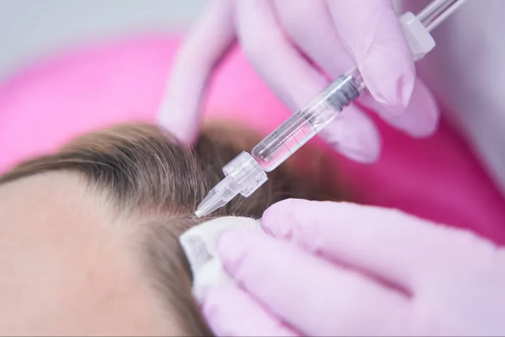 7 Effective Methods to Cover Hair Loss