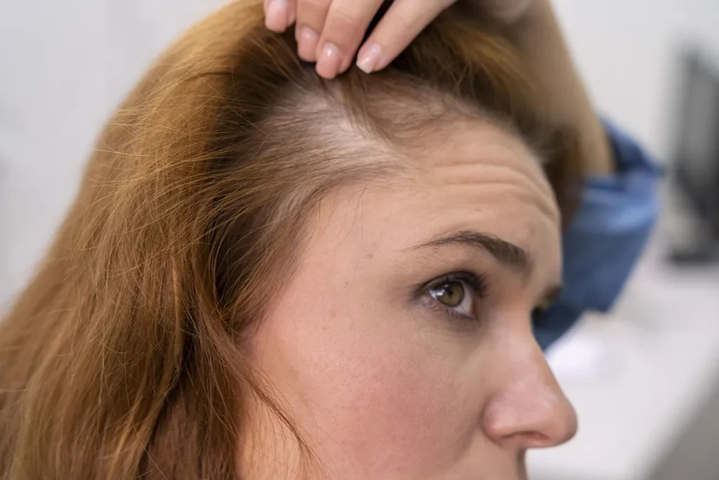 Disease Of The Hair: Best Treatment Guide