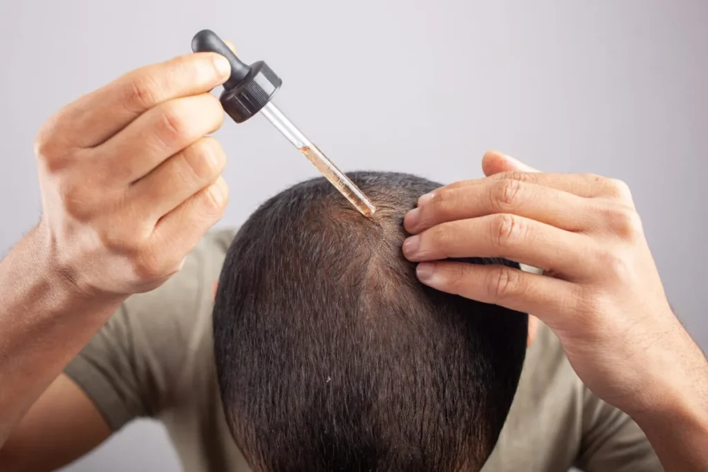 Do Hair Growth Supplements Work? The Truth