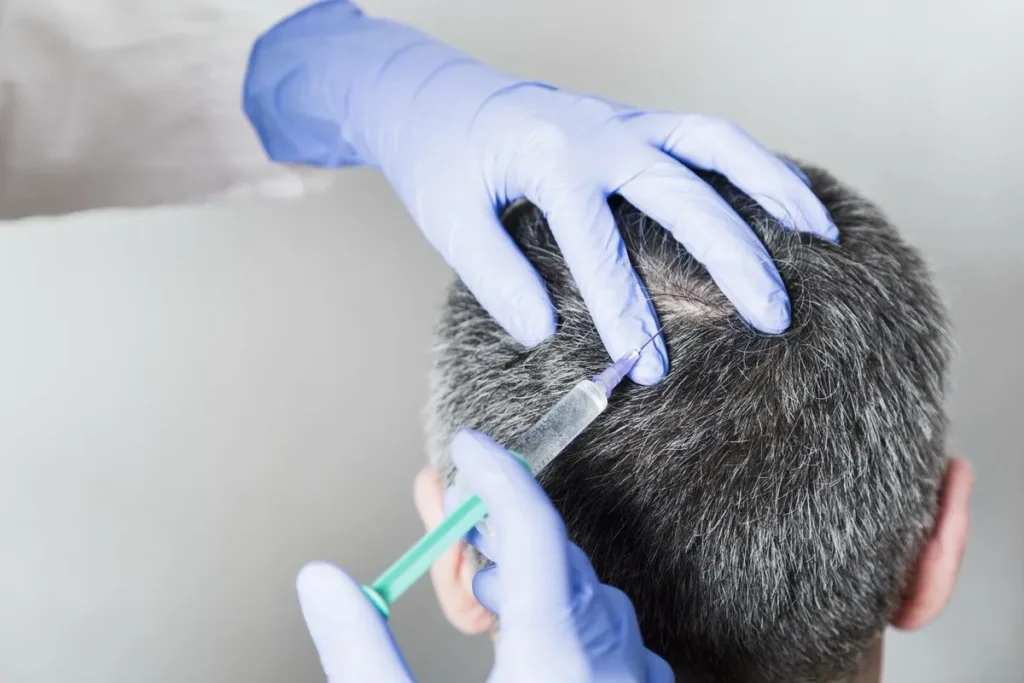 Do Stem Cells Regrow Hair? Amazing Future