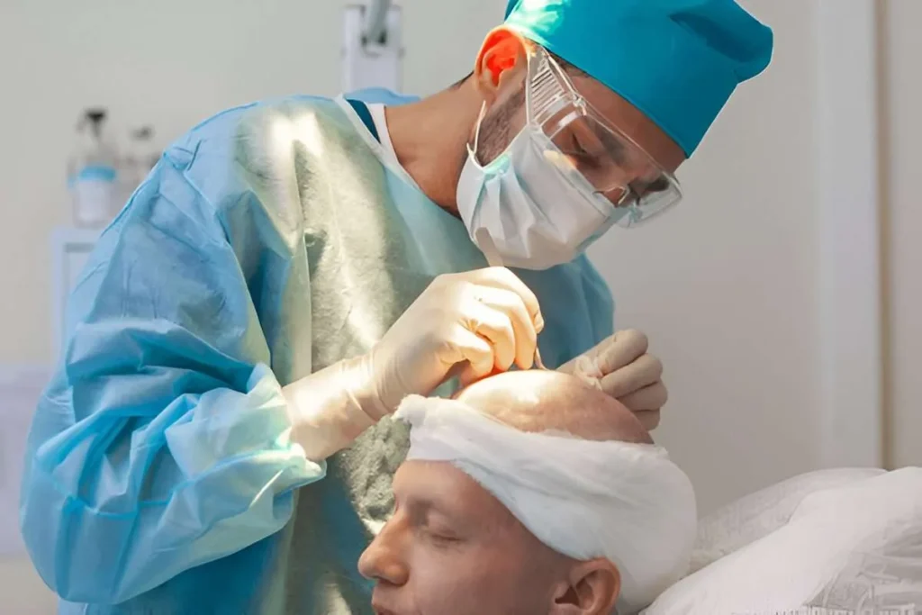 Does Hair Transplant Hair Fall Out? The Complete Timeline