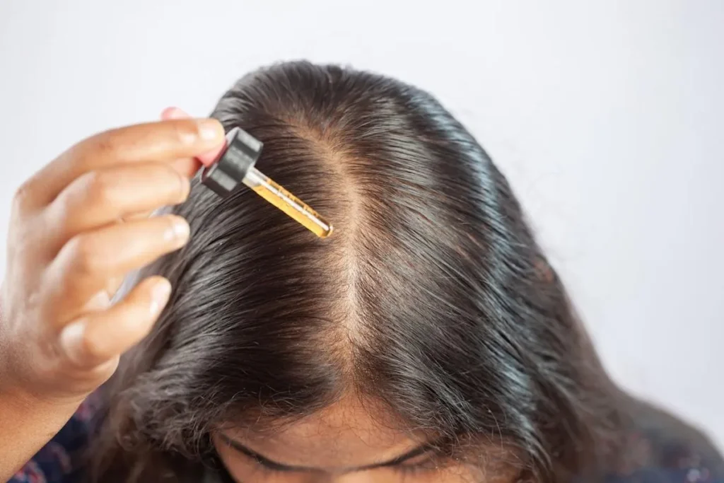 Does Hers Work for Hair Loss? Clinical Evidence