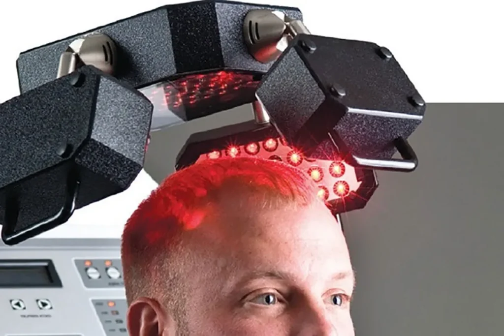 Does Laser Hair Regrowth Work? Proof Inside
