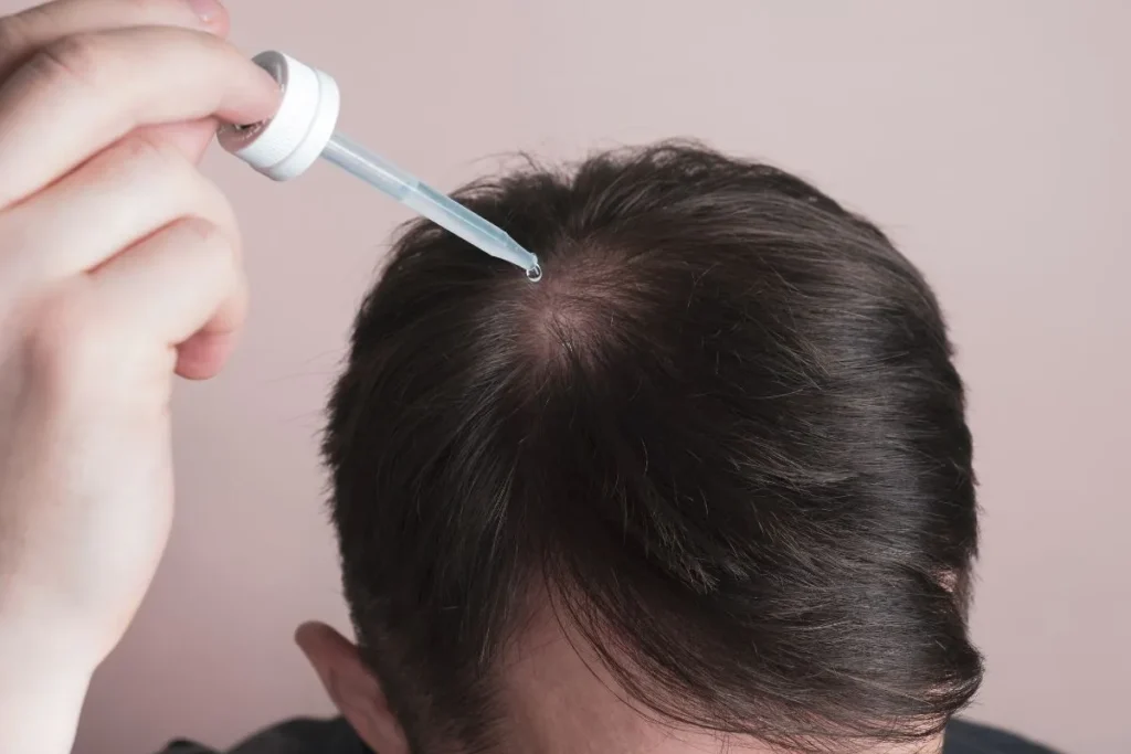 Understanding How Minoxidil Works