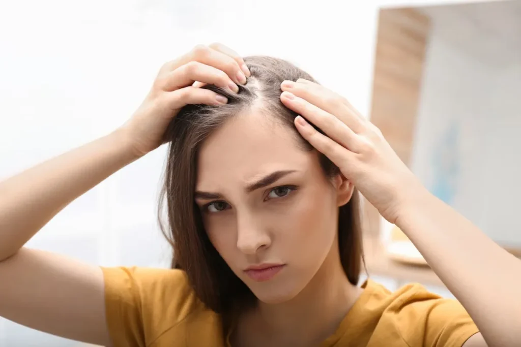 Female Androgenic Alopecia: Amazing Relief