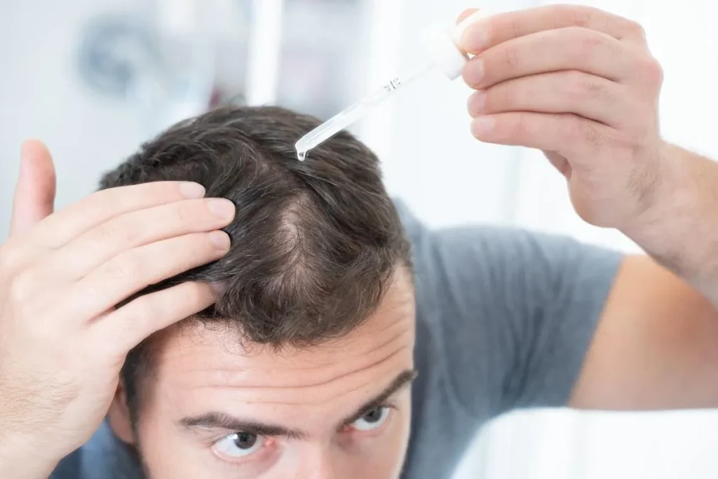 What Happens When You Finasteride Stop: Timeline and Effects