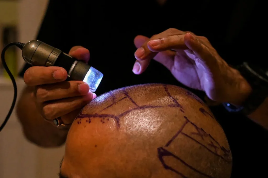 Fut Surgery: Amazing Recovery Secrets