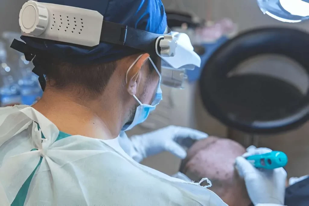 What is a FUT Transplant: The Basics of Follicular Unit Transplantation