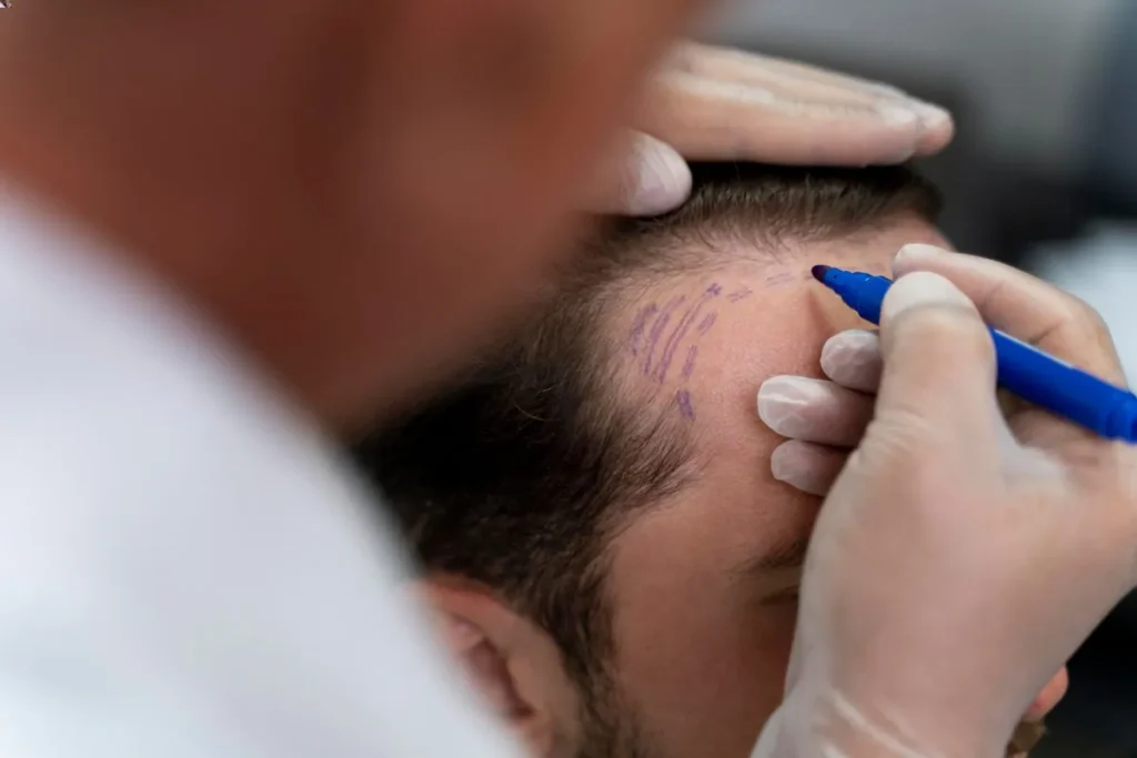 Hair Coming Out In Clumps: Sudden Help