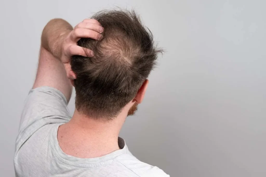 Hair Leg Loss: 7 Shocking Causes In Men