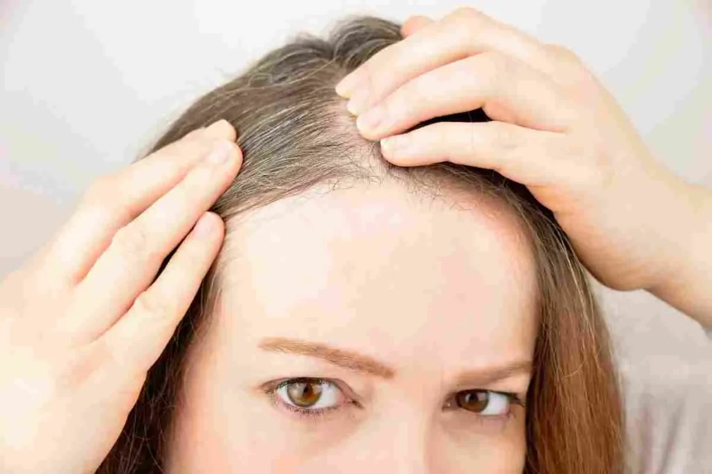 Hair Loss At A Young Age: Amazing Fixes