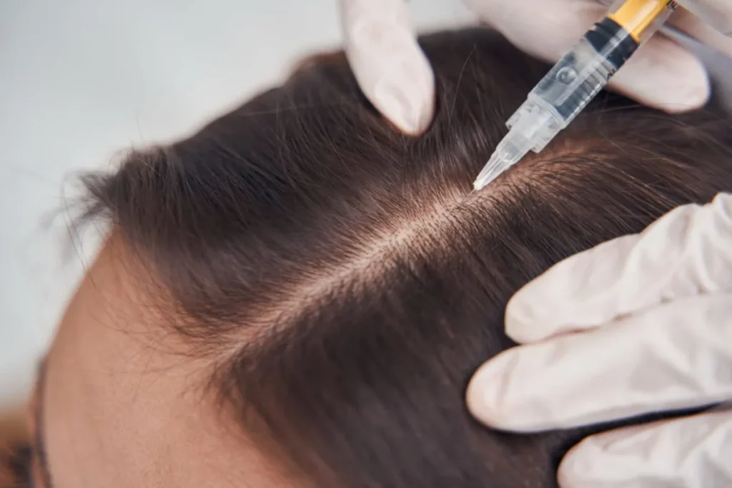 Hair Steroid: Best Guide To Fast Regrowth