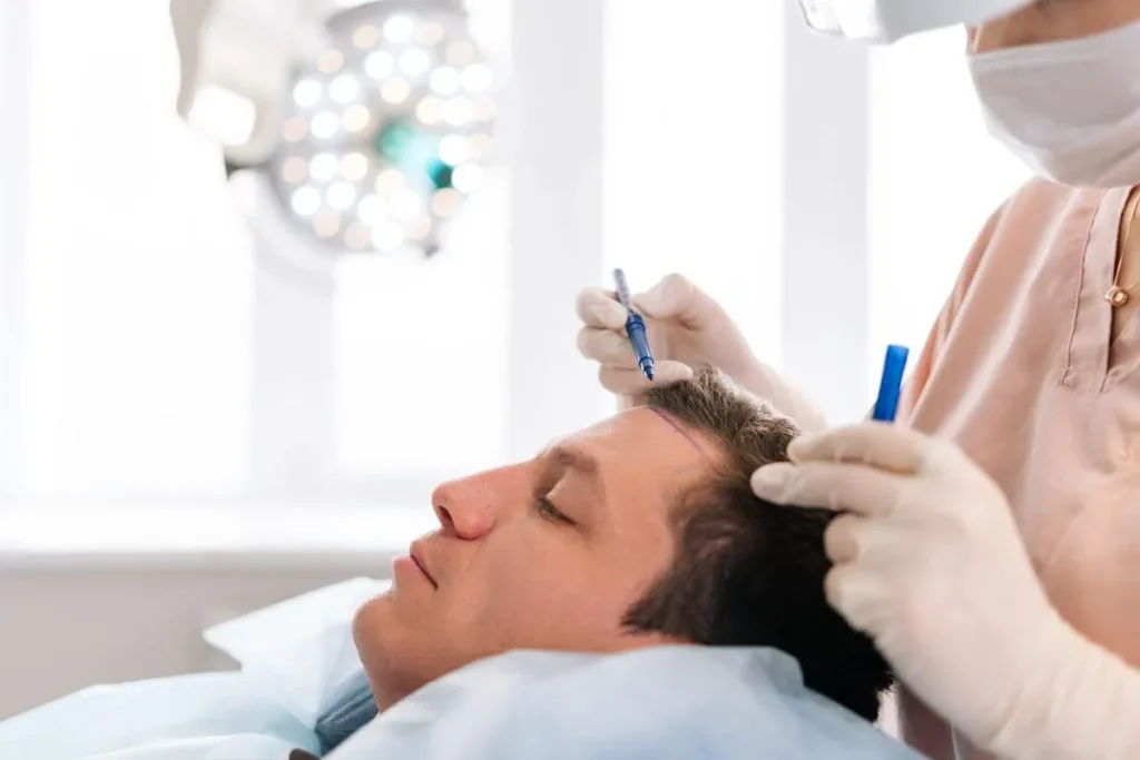 Hair Surgery Options: Best For Men