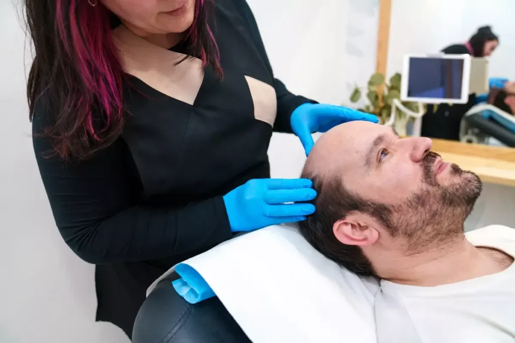 Hair Transplant 6 Months vs 1 Year: A Detailed Look