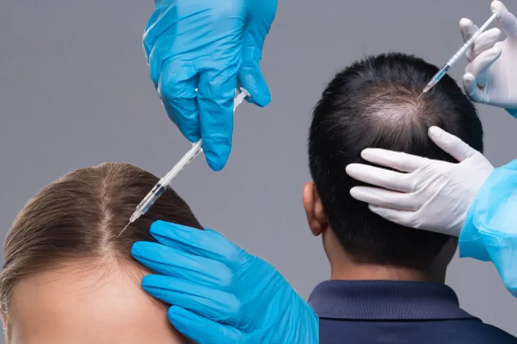 Hair Transplant Scar: Amazing Repair Tips