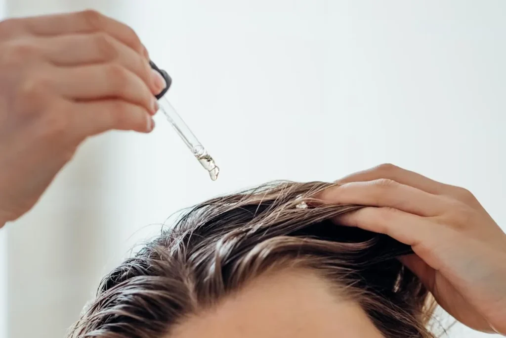 Understanding Receding Hairlines and Their Impact