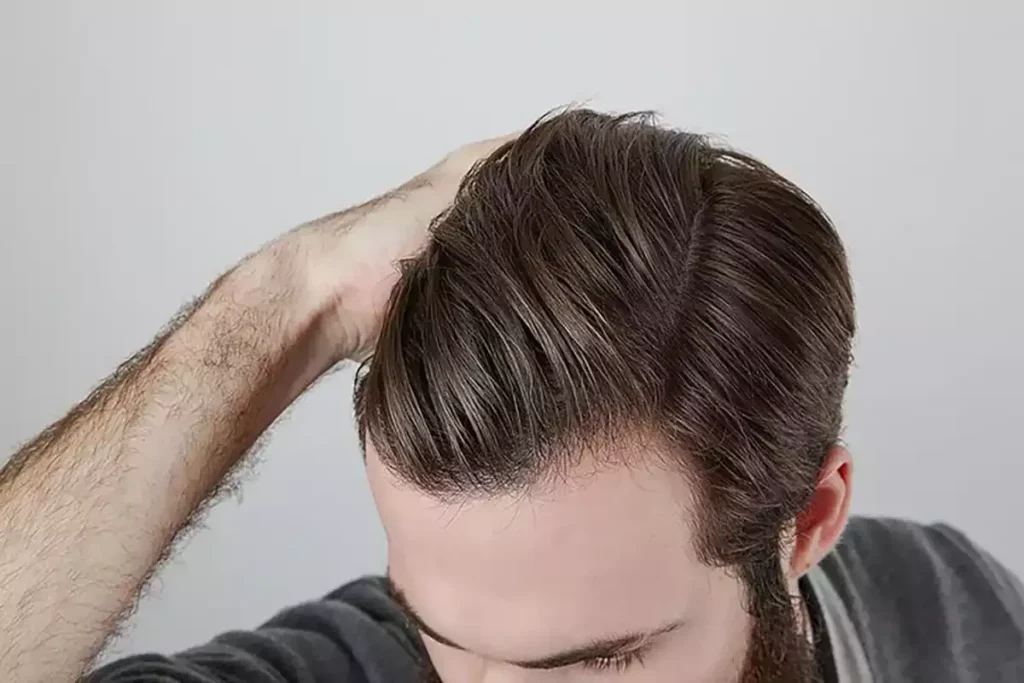 How Long Does It Take To Grow Your Hair Back?