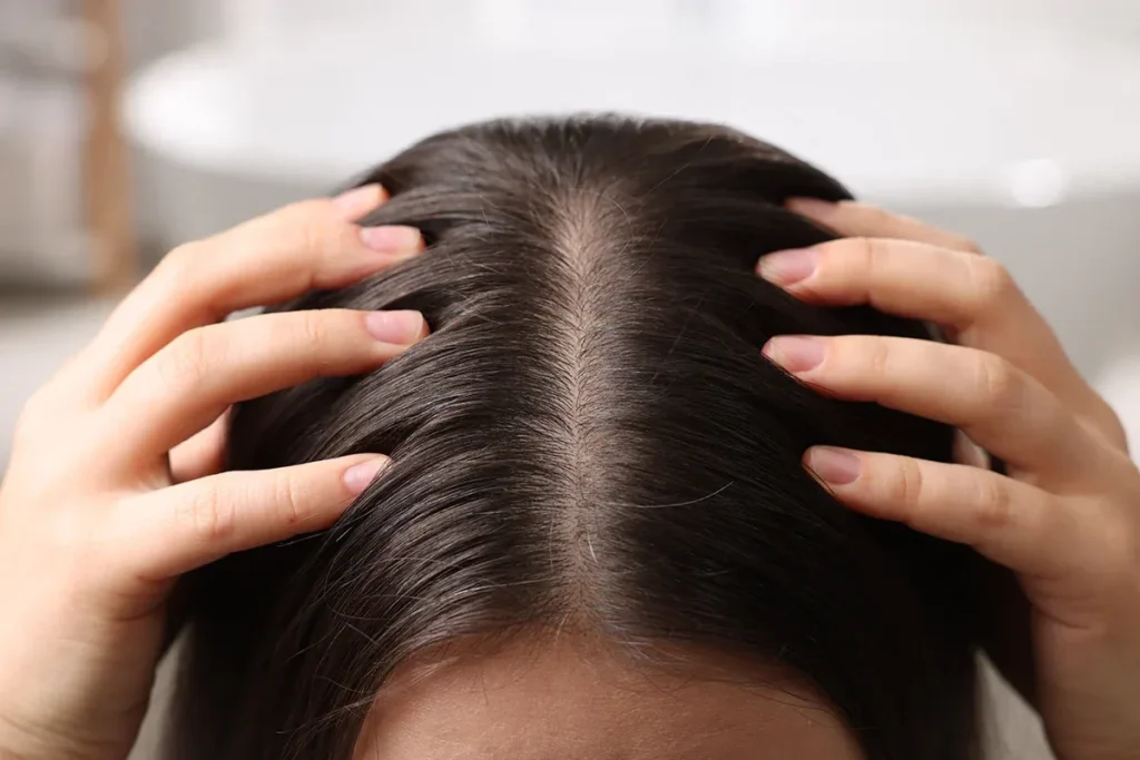 How To Promote Hair Growth In Women: Best Tips