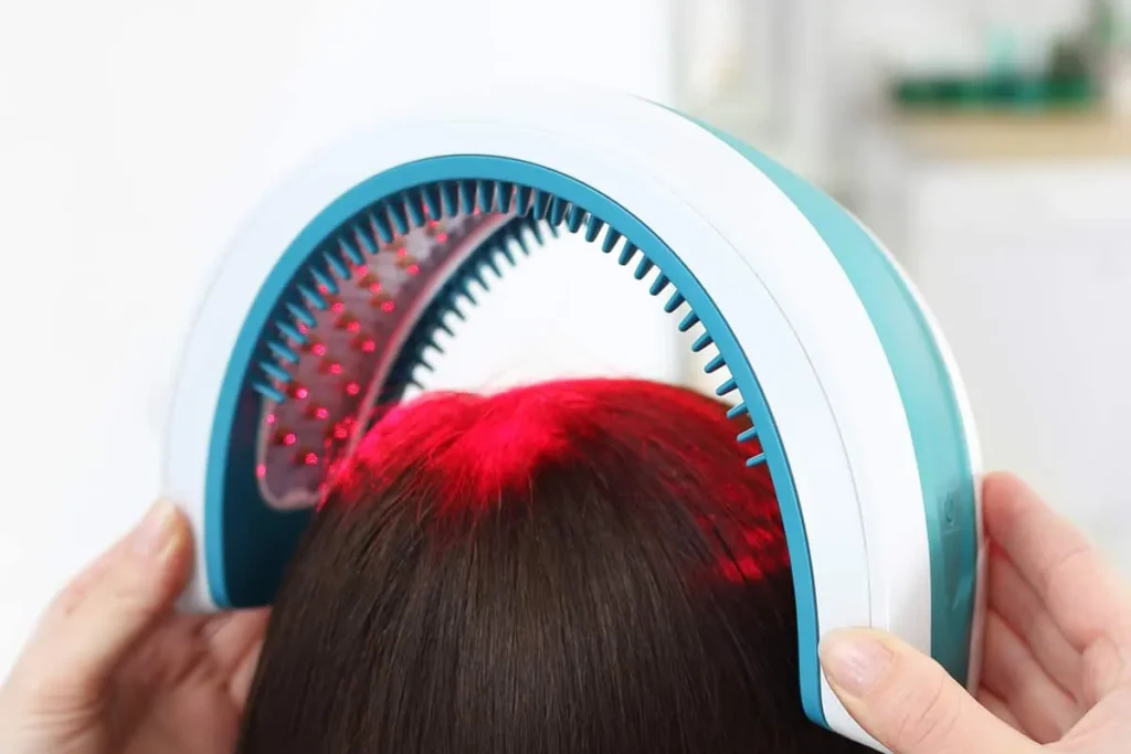 Laser Light Hair Restoration: Best Results