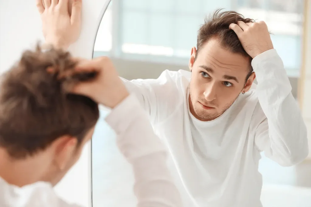 Losing Hair In 20s: Powerful Solutions
