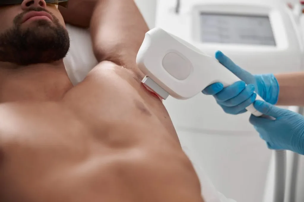 Losing Hair Under Arms: Shocking Reasons