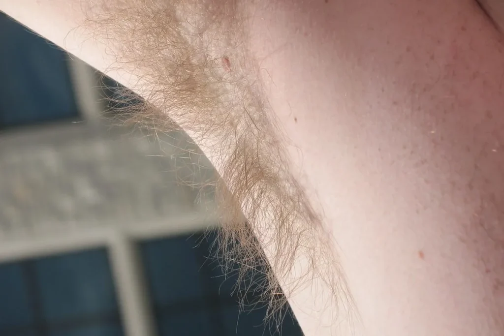 Loss Of Hair On Legs And Arms: Vital Info