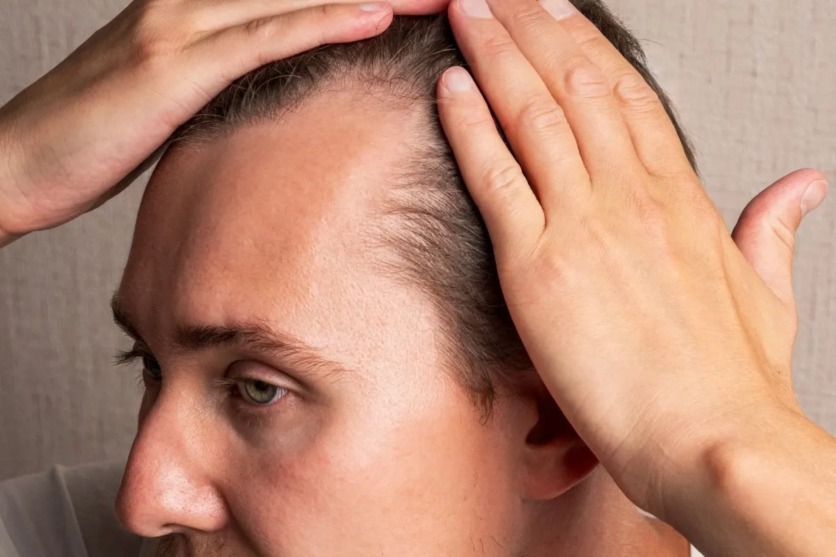 Male Pattern Baldness Long Hair: Secrets