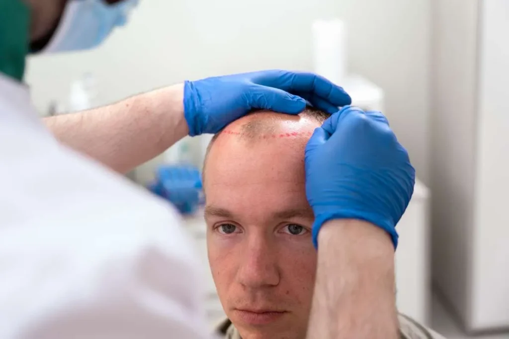 Non Surgical Hair Transplant: Best Fix