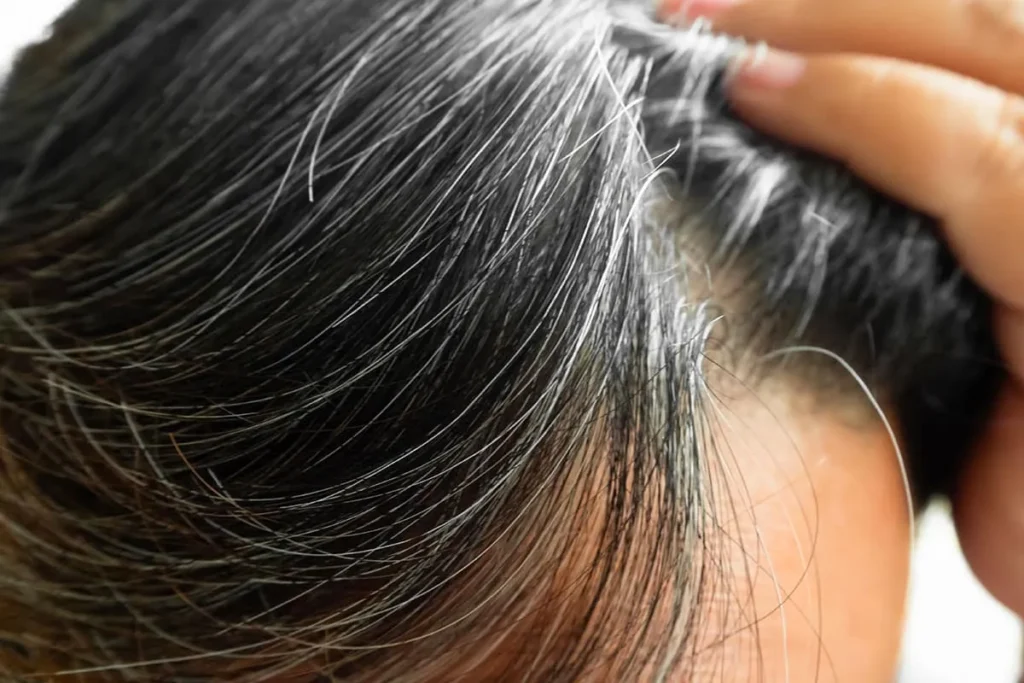 Normal Female Hairline: Amazing Secrets