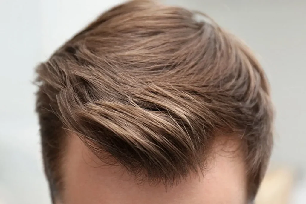 Normale haarlijn voor mannen: Krachtige tips