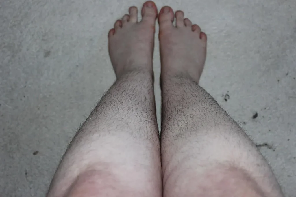 Patchy Leg Hair Female: Essential Facts