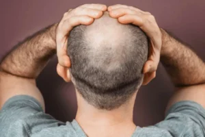 Microscopic view of exosomes used in hair therapy