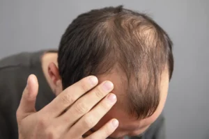 Professional scalp assessment at Gold City Medical Center