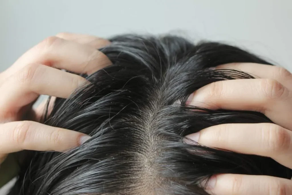 Sensitive Scalp And Hair Loss Treatment