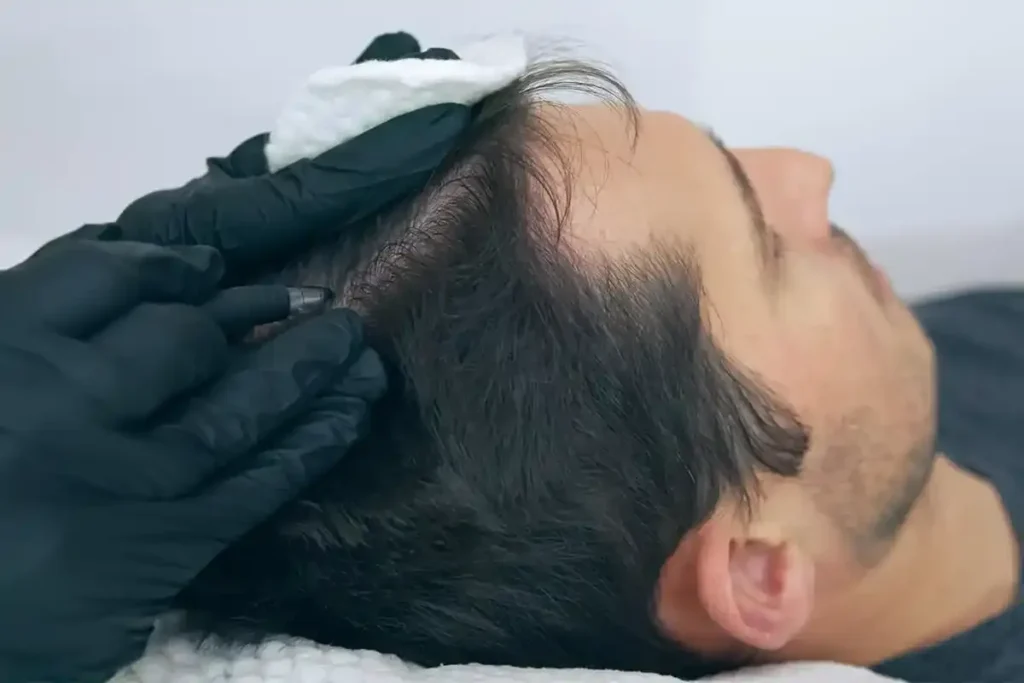Sensitive Scalp And Hair Loss Treatment