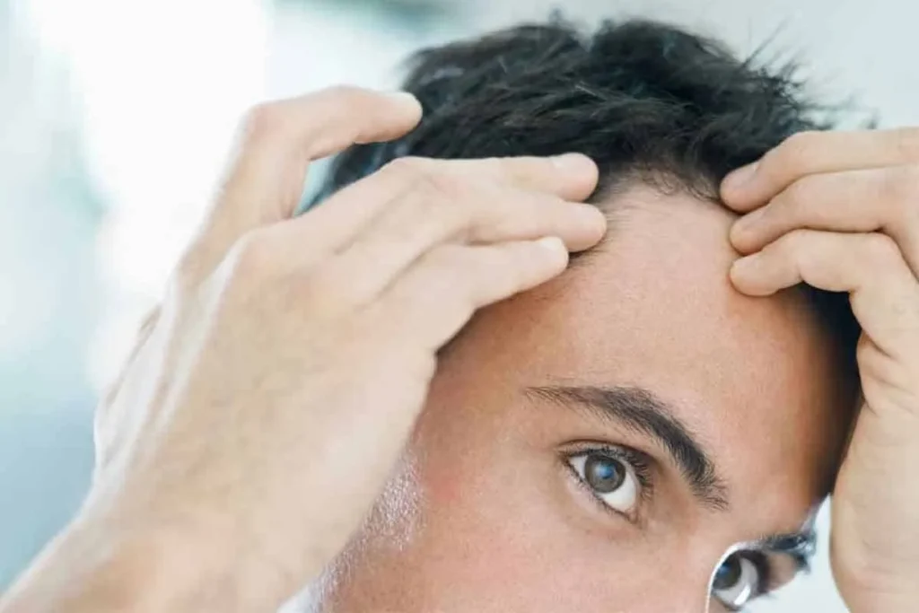 Signs Of Balding Male: Essential Guide