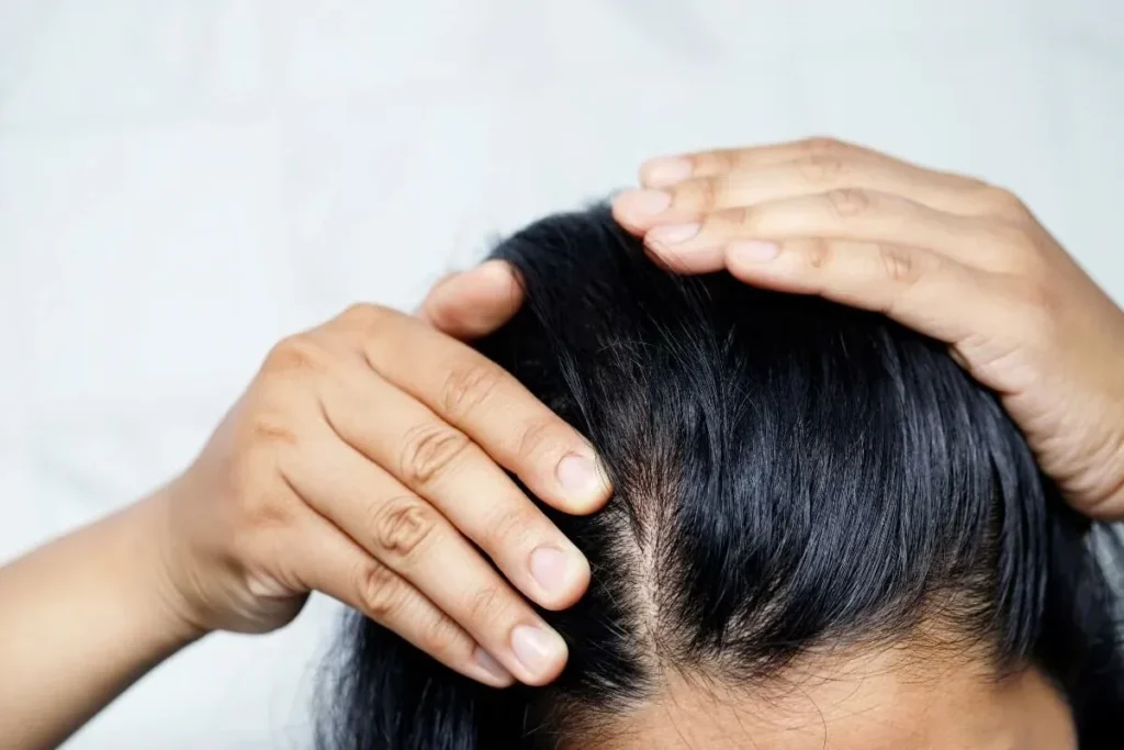 Signs Of Hair Loss: Incredible Early Fix