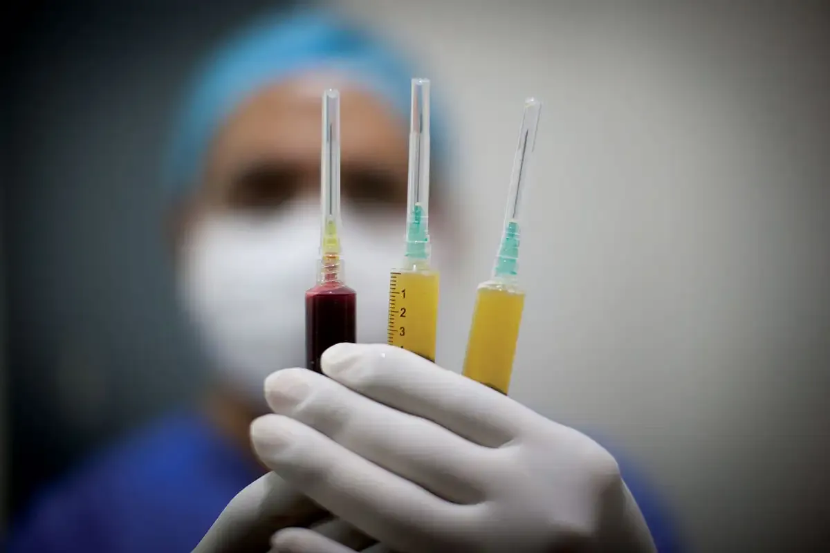 Stem Cell Therapy For Hair Loss Before And After