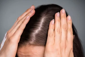 A specialist discussing hair thinning causes with a patient