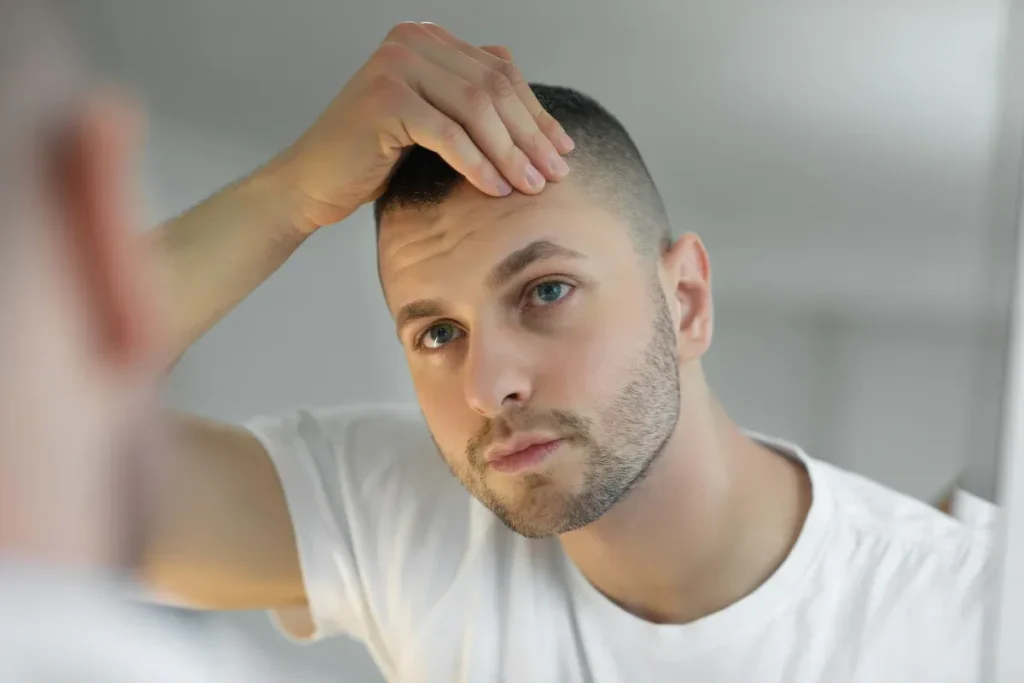 Topical Finasteride Dosage: Best Results