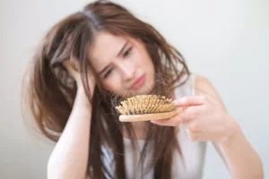 Treatment Of Alopecia Areata In Childhood