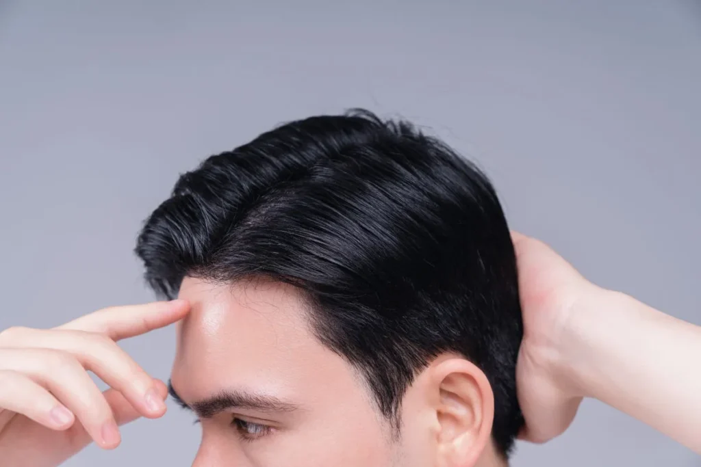 Weird Hairline: Powerful Fixing Secrets