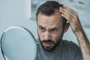 Common causes of baldness